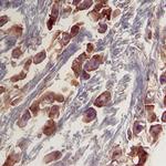 CYR61 Monoclonal Antibody (466305)