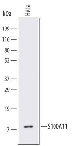 S100A11 Monoclonal Antibody (672816)
