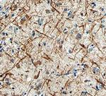 LRRTM3 Monoclonal Antibody (568318)