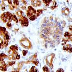 REG1A/REG1B Monoclonal Antibody (431211)