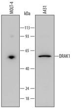 DRAK1 Monoclonal Antibody (684324)