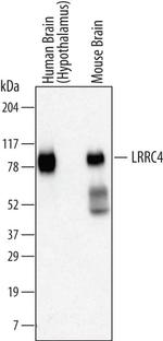 LRRC4 Antibody in Western Blot (WB)
