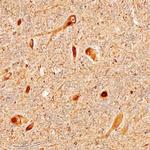 LRRC4 Monoclonal Antibody (701419)