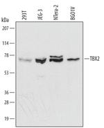 TBX2 Monoclonal Antibody (393725)