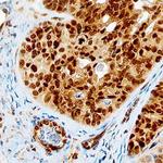 MSX1 Antibody in Immunohistochemistry (Paraffin) (IHC (P))