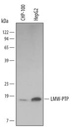 Acid Phosphatase 1 Monoclonal Antibody (475417)