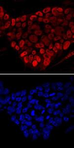 FOXD3 Monoclonal Antibody (800602)