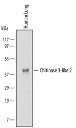 CHI3L2 Monoclonal Antibody (632010)