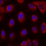 Nicastrin Monoclonal Antibody (716918)