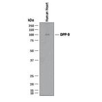 DPP9 Monoclonal Antibody (988515)