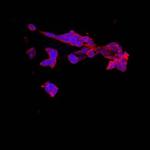 NELL1 Antibody in Immunocytochemistry (ICC/IF)