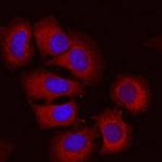 SEMA3C Monoclonal Antibody (757820)