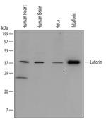 EPM2A Antibody in Western Blot (WB)