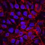 GDF3 Monoclonal Antibody (741614)