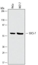 SOCS7 Monoclonal Antibody (519106)