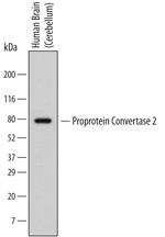 PCSK2 Antibody in Western Blot (WB)