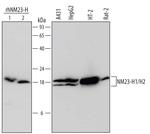 NME1/NME2 Monoclonal Antibody (642825)