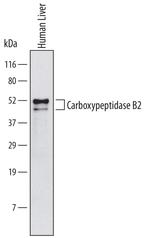 Carboxypeptidase B2 Monoclonal Antibody (650801)