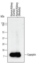 Copeptin Monoclonal Antibody (579021)