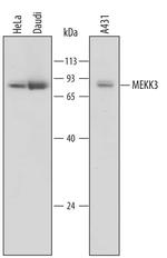 MEKK3 Monoclonal Antibody (576240)