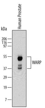 VWA1 Monoclonal Antibody (559915)