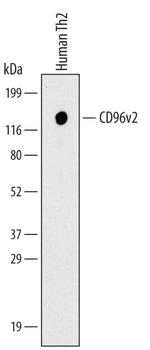 CD96v2 Antibody in Western Blot (WB)