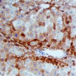 MSP Monoclonal Antibody (757320)