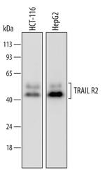 TRAIL-R2 (DR5) Antibody in Western Blot (WB)