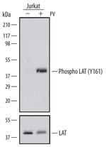 Phospho-LAT (Tyr161) Monoclonal Antibody (627945)
