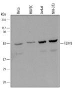 TBX18 Monoclonal Antibody (635303)