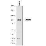ZNF281 Monoclonal Antibody (801706)