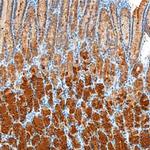 GKN1 Monoclonal Antibody (665701)