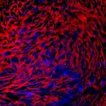 PRELP Monoclonal Antibody (754633)