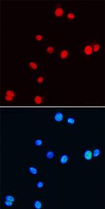 Nkx3.1 Monoclonal Antibody (738907)