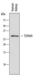 TSPAN9 Monoclonal Antibody (590409)