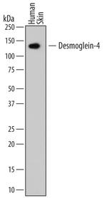 Desmoglein 4 Antibody in Western Blot (WB)