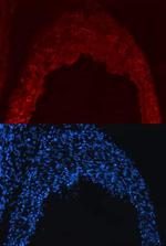 Nogo-B Monoclonal Antibody (523808)