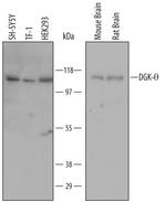 DGKQ Monoclonal Antibody (652308)