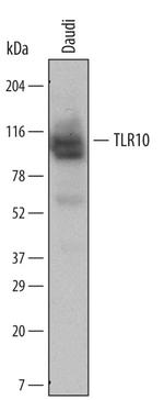 TLR10 Antibody in Western Blot (WB)