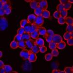 PCDH15 Monoclonal Antibody (740523)