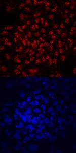 ZNF143 Monoclonal Antibody (677314)
