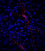 VGAT Antibody in Immunocytochemistry (ICC/IF)