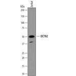 Dynactin 2 Monoclonal Antibody (696206)