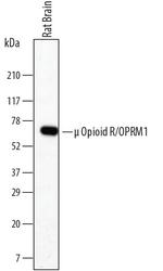 OPRM1 Monoclonal Antibody (677014)