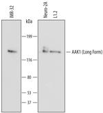 AAK1 Monoclonal Antibody (702425)