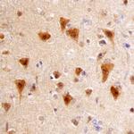 APH1 Monoclonal Antibody (665404)