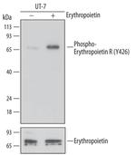 Phospho-EpoR (Tyr426) Monoclonal Antibody (690710)