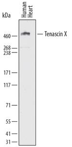 TNXB Monoclonal Antibody (766842)