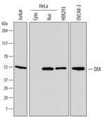 DEK Monoclonal Antibody (715524)