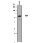 PRCP Monoclonal Antibody (860821)